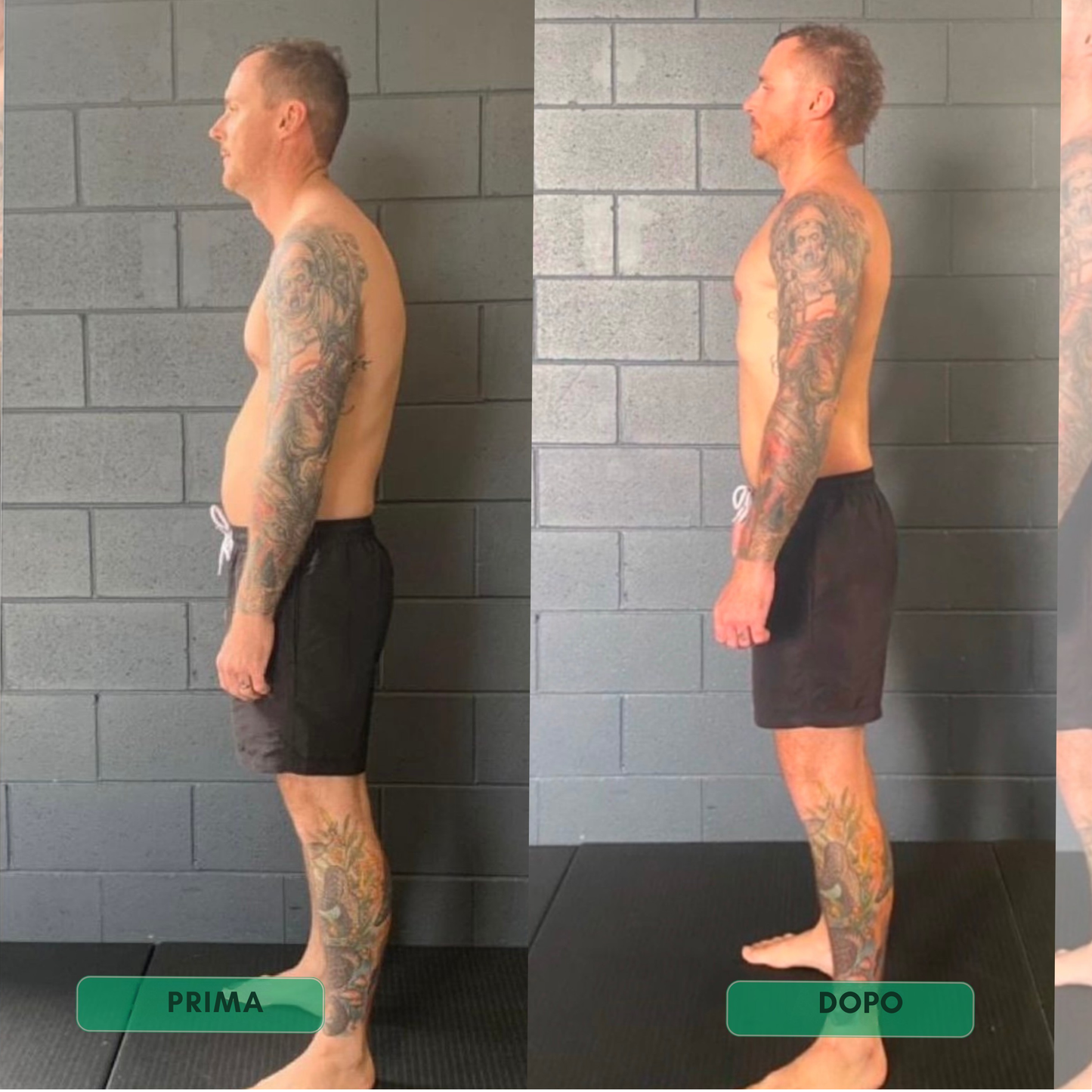 AxisPro|Correttore posturale