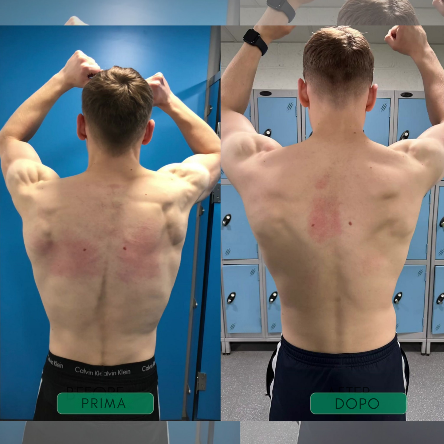 AxisPro|Correttore posturale